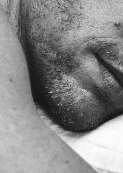 liposuccion-double-menton